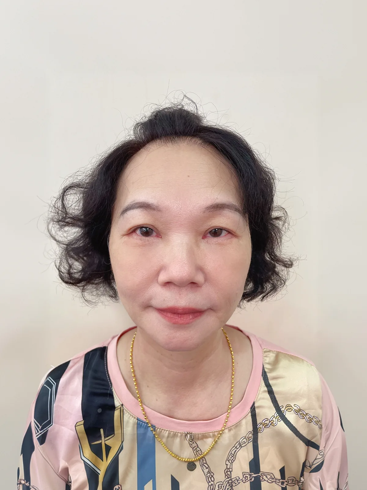 術後