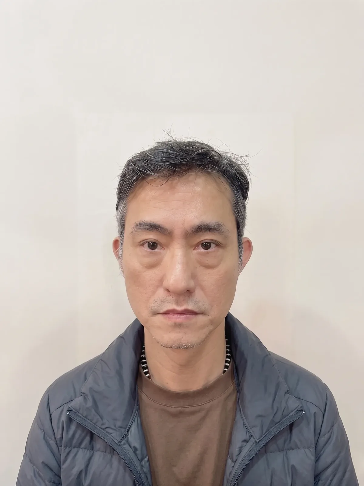 術前