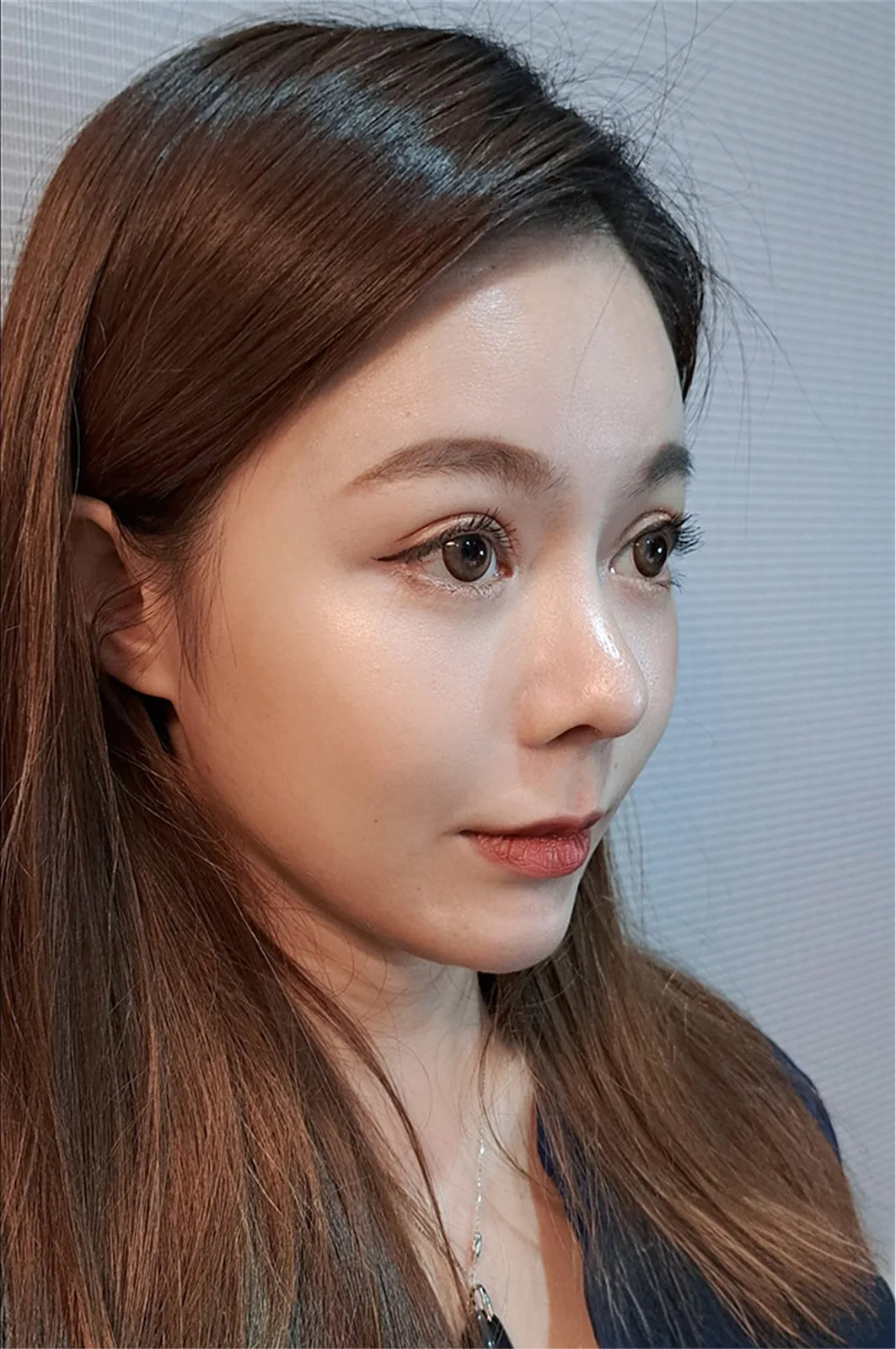 術後