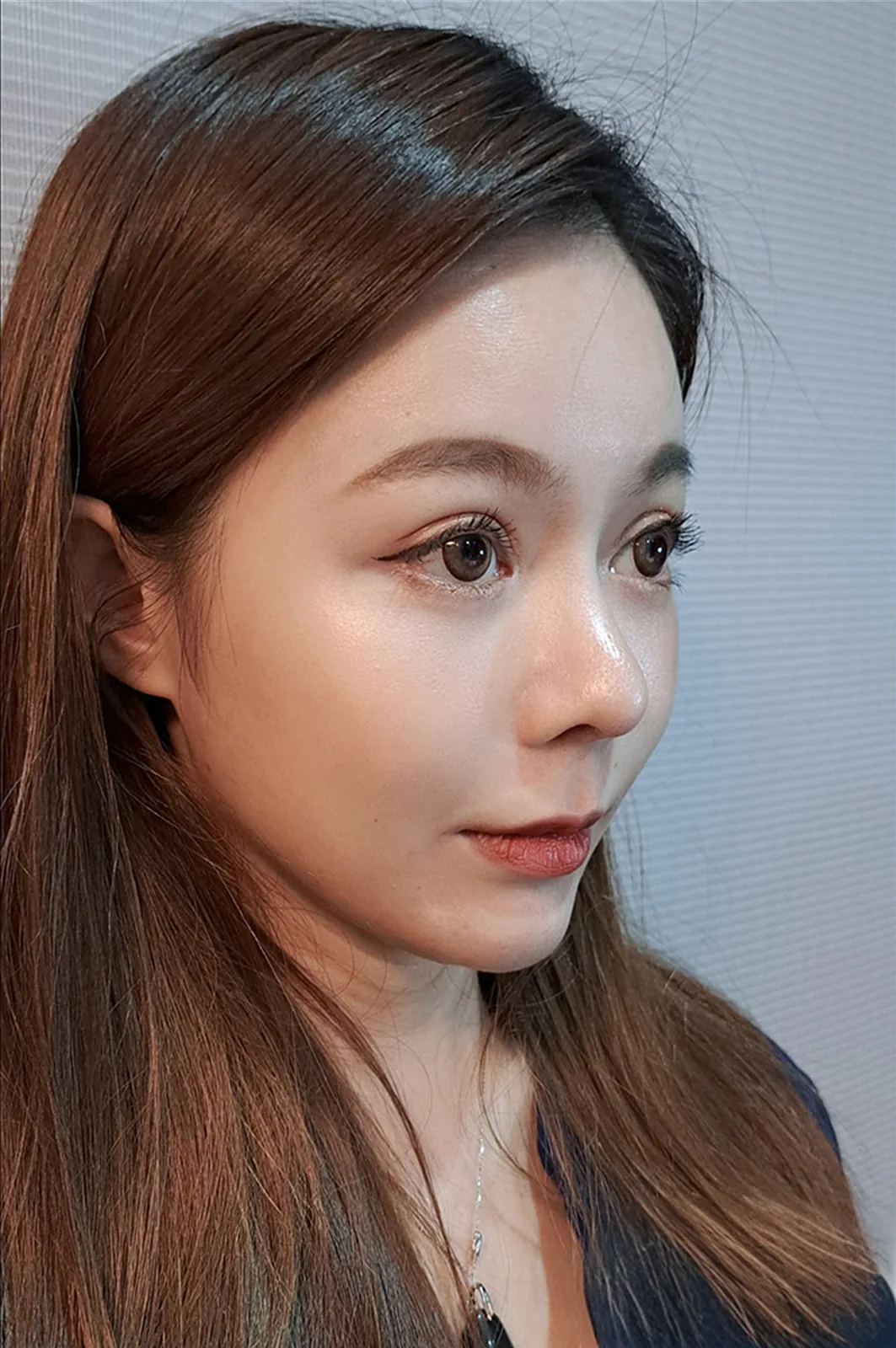 術後