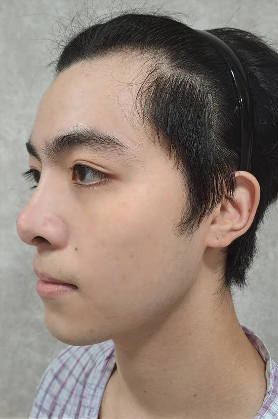 術前