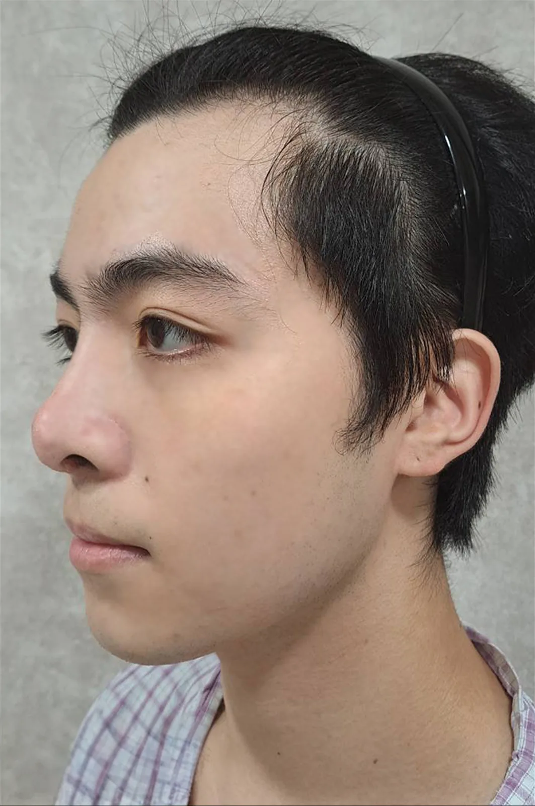 術前
